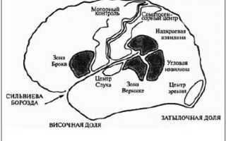 Синдром лсма что это такое