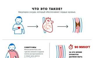 Острый коронарный синдром симптомы признаки
