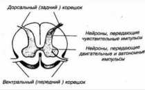 Корешковый синдром на фоне поясничного остеохондроза