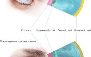Что может вылечить синдром сухого глаза
