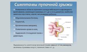 Расширенное пупочное кольцо код по мкб 10