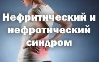 Нефротического синдрома мочевого или гипертонического