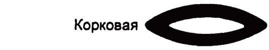  Корковая катаракта