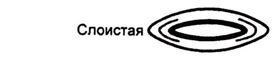 Слоистая катаракта