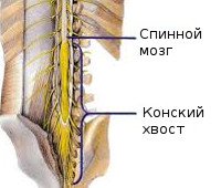 Синдром конского хвоста