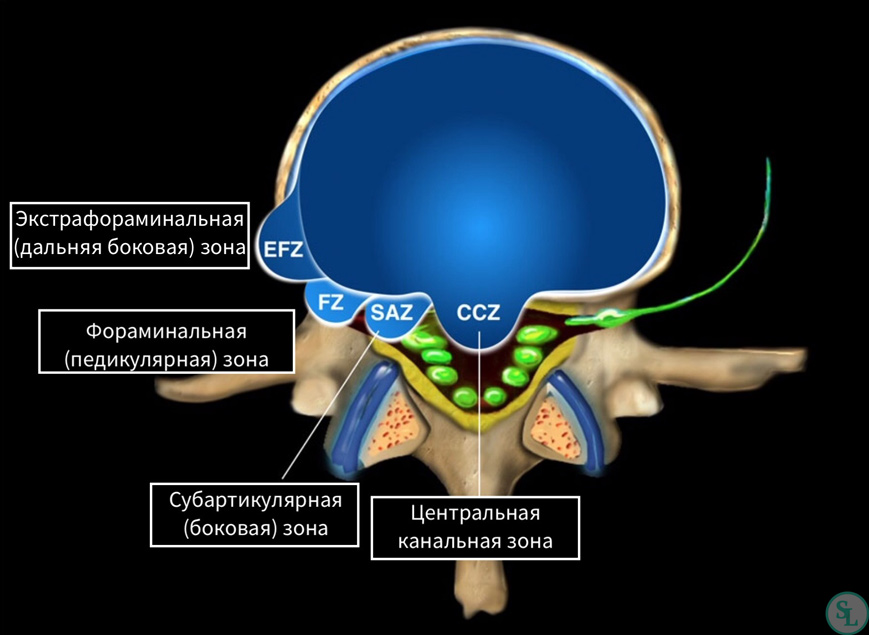 Циркулярная или диффузная