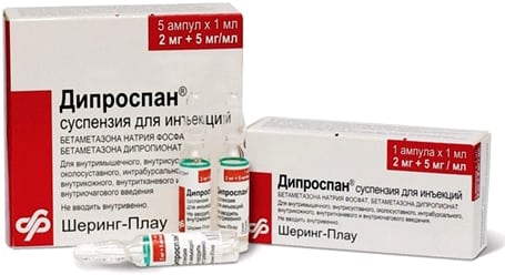 Чем обезболить болевой синдром грыжи позвоночника