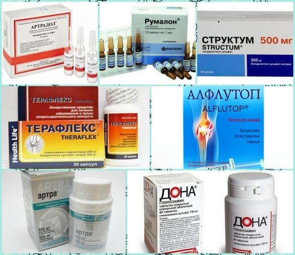 Что такое остеохондроз проявление болевые синдромы лечение