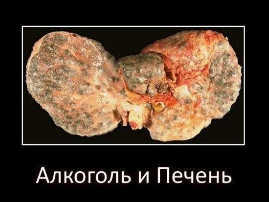 Алкоголь и печень