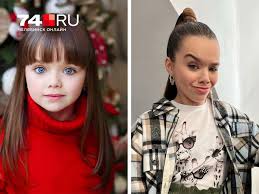 Синдром дауна
