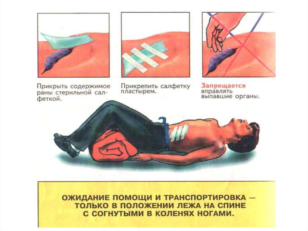 Код мкб ножевое ранение живота