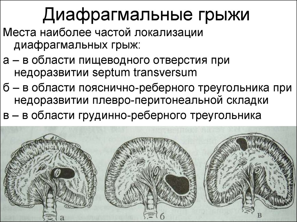 Расширенное пупочное кольцо код по мкб 10